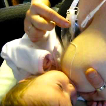 Supplemental Nursing System (SNS), baby feeding